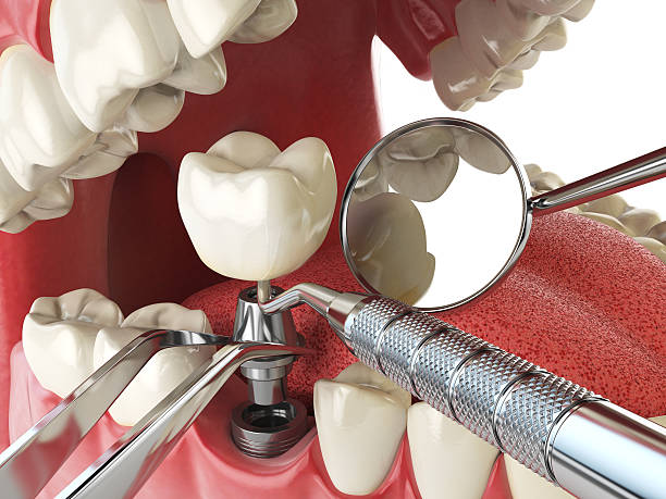 Best Weekend Emergency Dentist in Quartz Hill, CA